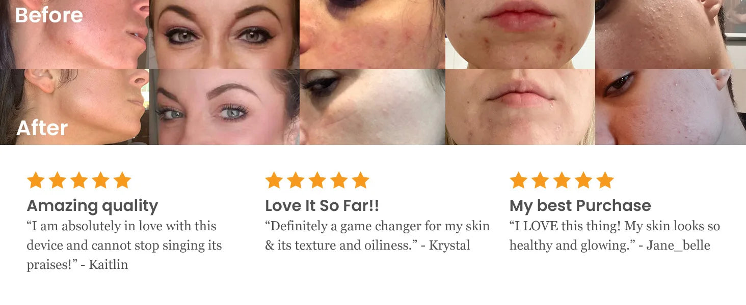 Before and after results using high frequency facial machine